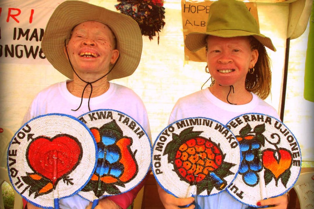 13 de  Junio: Día Internacional de Sensibilización sobre el Albinismo