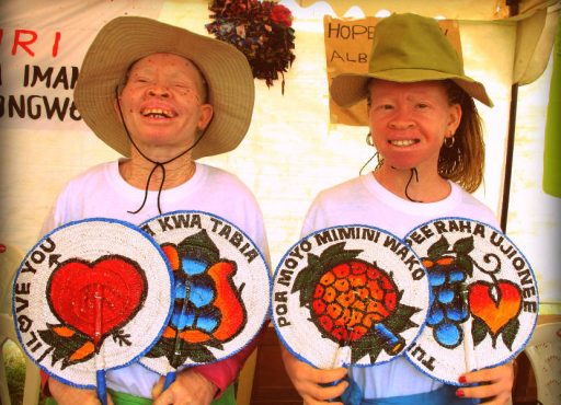 13 de  Junio: Día Internacional de Sensibilización sobre el Albinismo