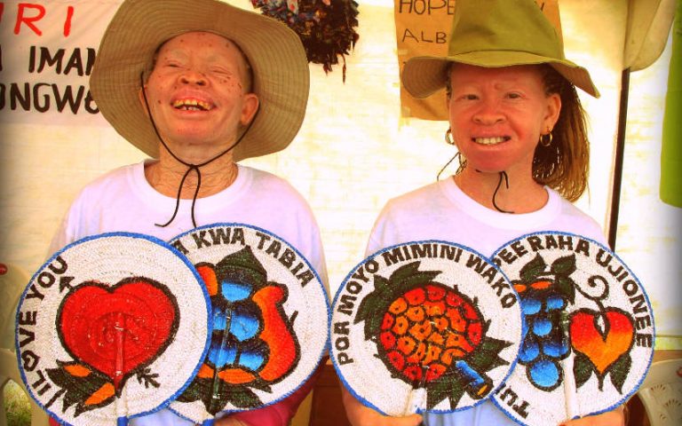 13 juin : Journée internationale de sensibilisation à l’albinisme