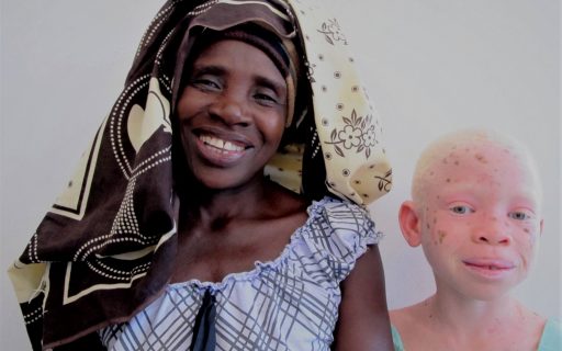 ¿Por qué hay más personas con albinismo en África que en Europa?