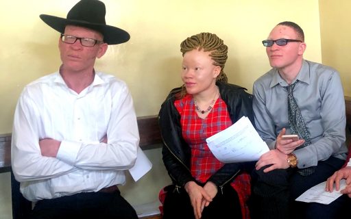 Entrevistamos al Coordinador Nacional de la Asociación de Personas con Albinismo de Malaui