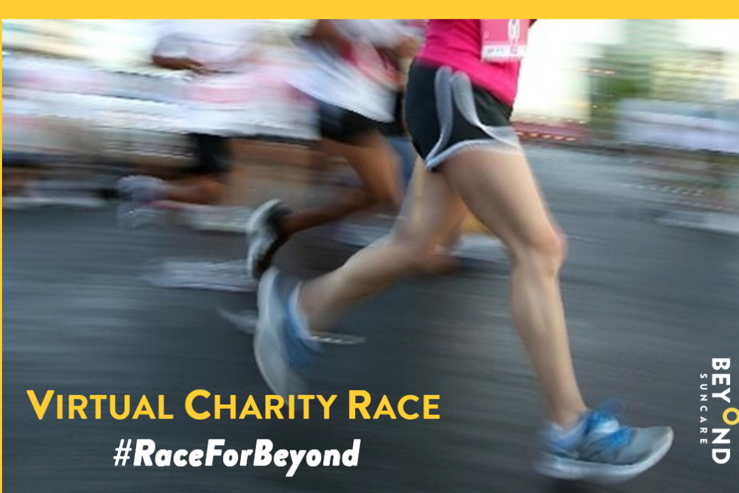 VIRTUAL CHARITY RACE TO CELEBRATE INTERNATIONAL ALBINISM DAY