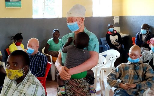 COVID-19 y albinismo en Malaui