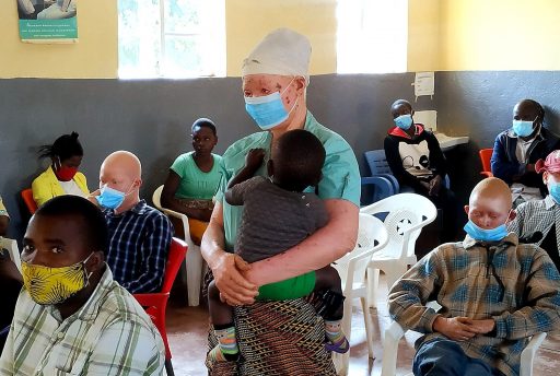 COVID-19 y albinismo en Malaui