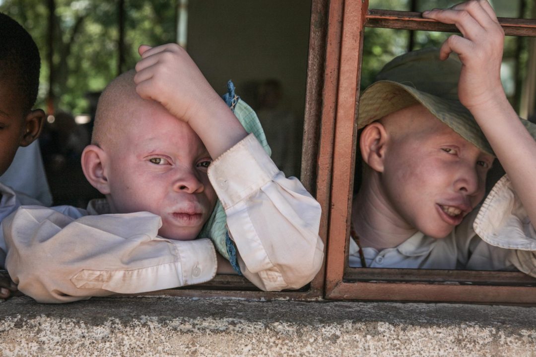 Somos «oficialmente» ONG para el Desarrollo