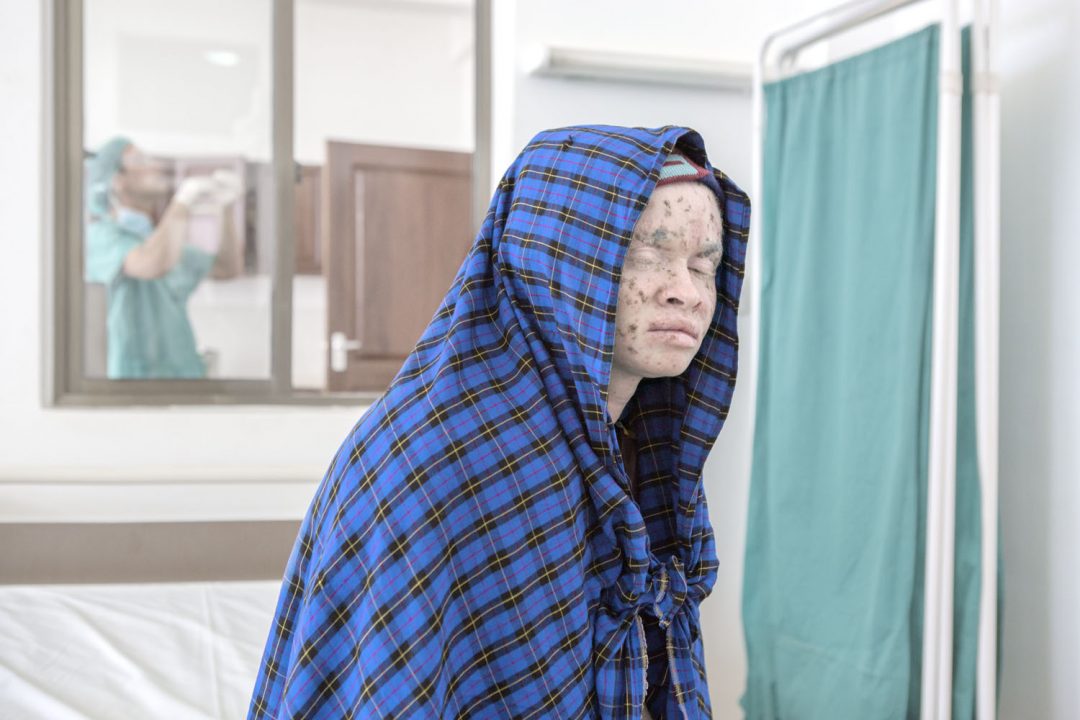 El cáncer de piel es el cáncer más frecuente en el ser humano