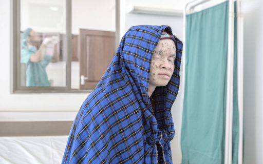 El cáncer de piel es el cáncer más frecuente en el ser humano