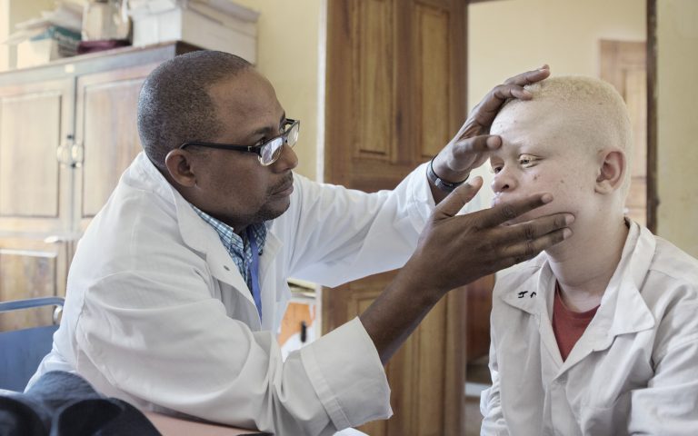 10 cosas que quizás no sabías sobre el albinismo