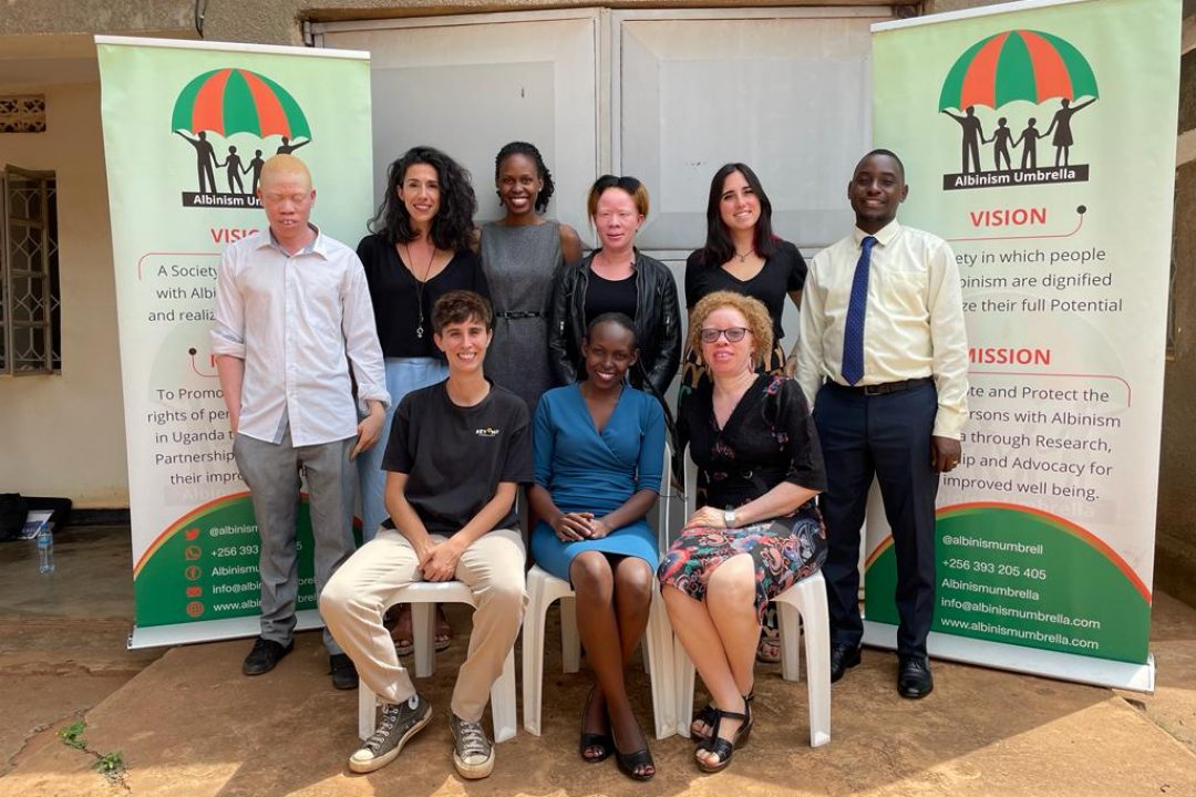 En Ruanda y Uganda nos proponemos apoyar a 1000 personas con albinismo