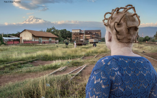 Día Internacional de Sensibilización sobre el Albinismo