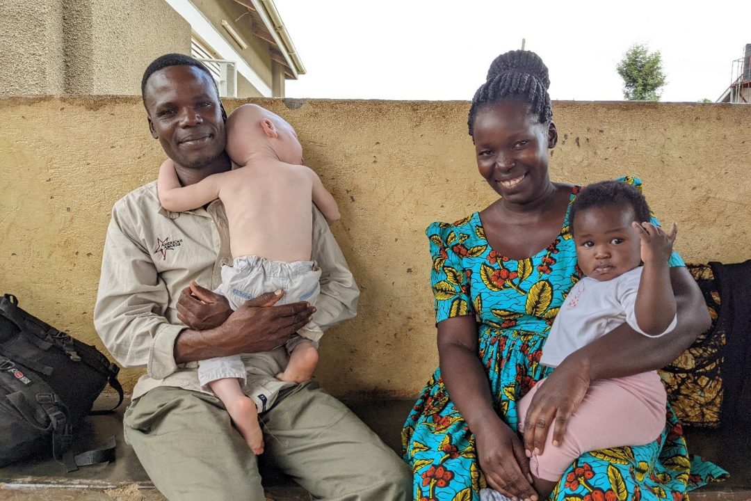 Una nueva historia se escribe para las personas con albinismo de Uganda