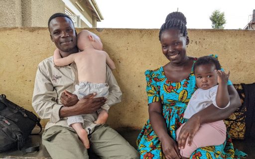 Una nueva historia se escribe para las personas con albinismo de Uganda