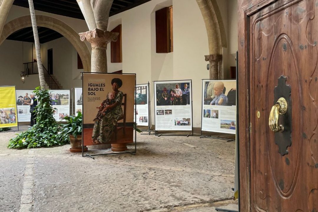 “Iguales bajo el sol”: una exposición que da voz a las personas con albinismo en África