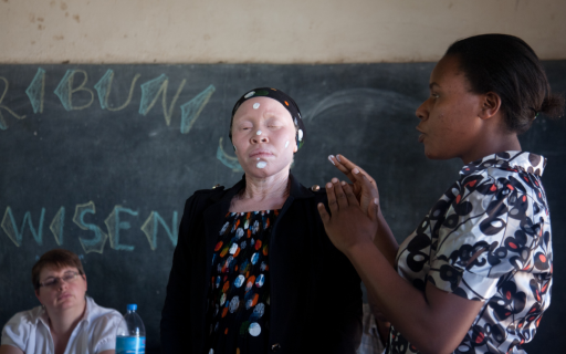 ¿Por qué no cualquier protector solar sirve para el albinismo?