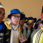 ¿Por qué la piel sin melanina sufre más?