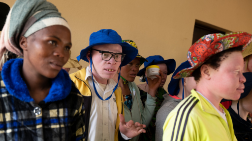 ¿Por qué la piel sin melanina sufre más?