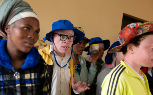 ¿Por qué la piel sin melanina sufre más?