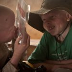 Visión y albinismo: un reto silencioso que impacta en la educación de los niños