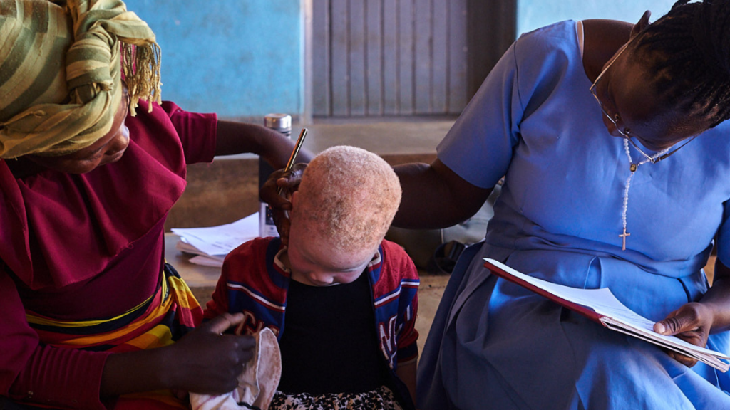 profesional de salud con persona con albinismo