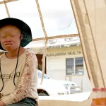 La salud de la piel entra en la agenda global