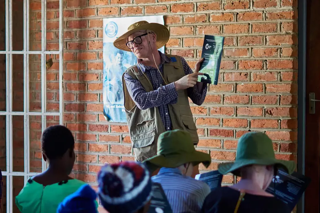 Prevenir el cáncer de piel en las personas con albinismo es un reto sistémico